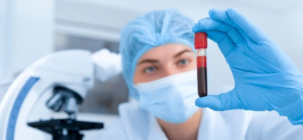 técnico de laboratorio con muestra de sangre